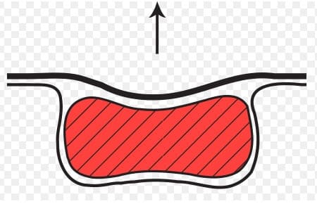 Thermoforming Vacuum Packaging